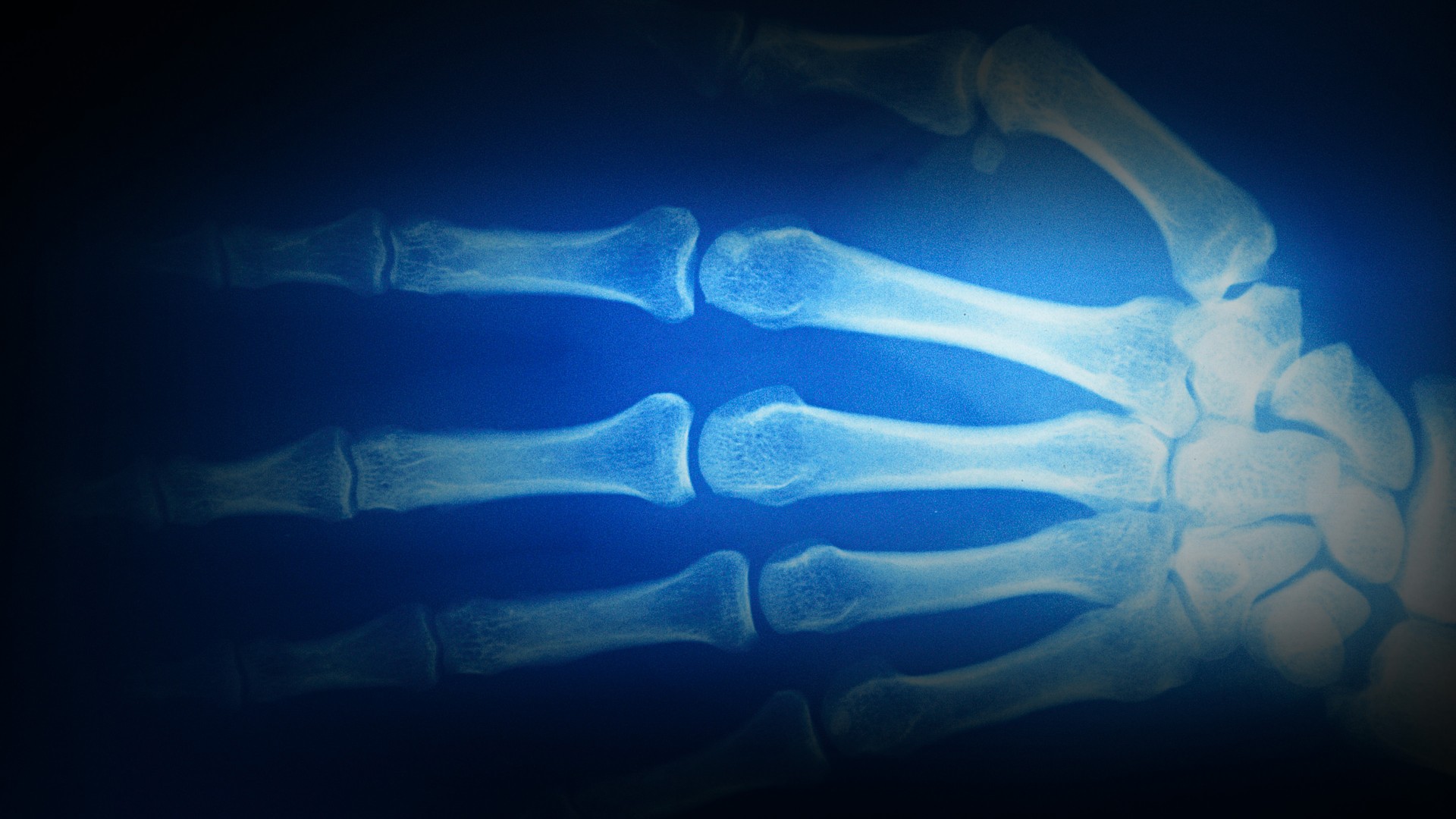 Diagnostícame