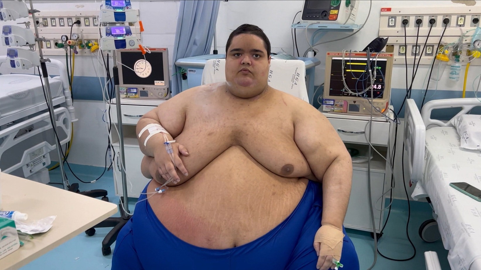 Mi vida con 300 kilos: Brasil